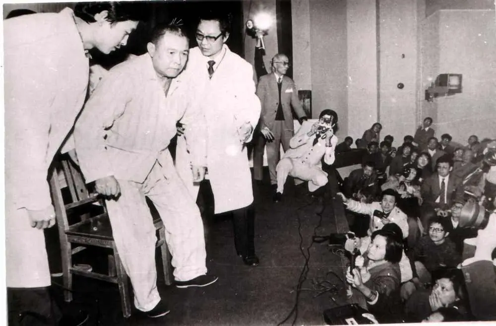 1987年11月北京日報報導朱明清教授於世界針聯大會的朱氏頭皮針中風現場示範