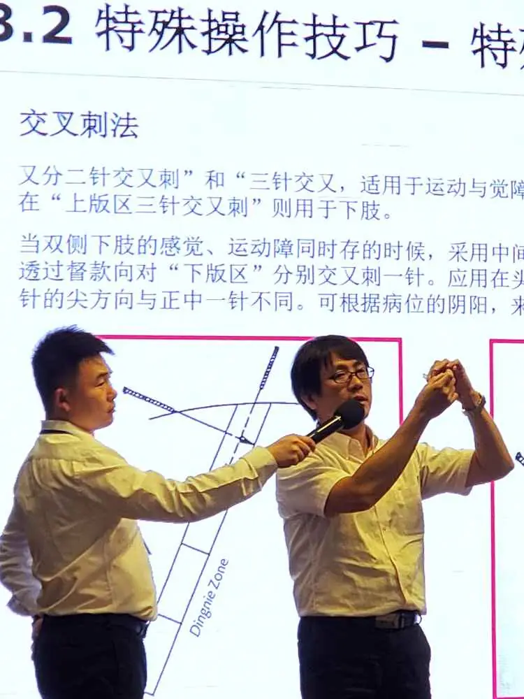 Dr. Sheng Chun Chang demonstrating a special Zhu's Scalp Acupuncture (ZSA) needling technique, 2019.